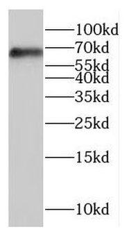 COLGALT2 Rabbit Polyclonal Antibody