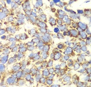 GLUD2 Rabbit Polyclonal Antibody