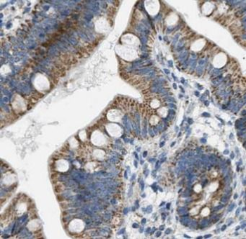 SLC2A2 Rabbit Polyclonal Antibody