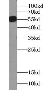 SLC2A4 Antibody