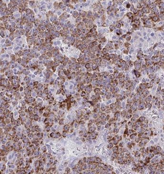 GPC3 Antibody