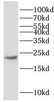 GM2A Rabbit Polyclonal Antibody