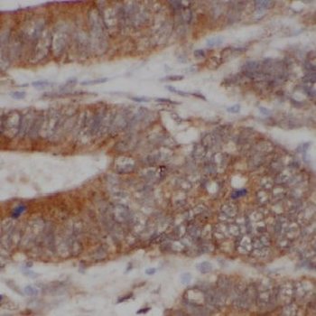 GM2A Rabbit Polyclonal Antibody