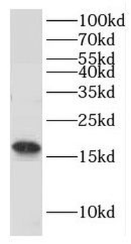 GMFB Rabbit Polyclonal Antibody