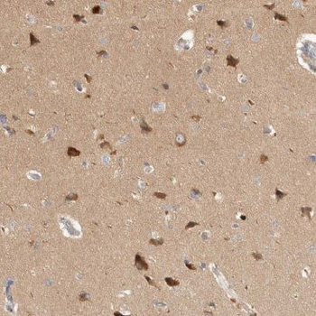 GMFB Rabbit Polyclonal Antibody