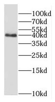 GNAI1 Rabbit Polyclonal Antibody