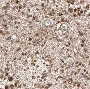 GNAI1 Rabbit Polyclonal Antibody