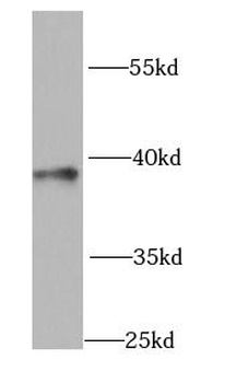 GNAO1 Antibody