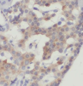 GNAS Antibody