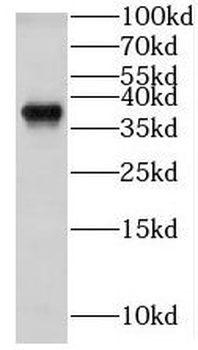 GNB1 Rabbit Polyclonal Antibody