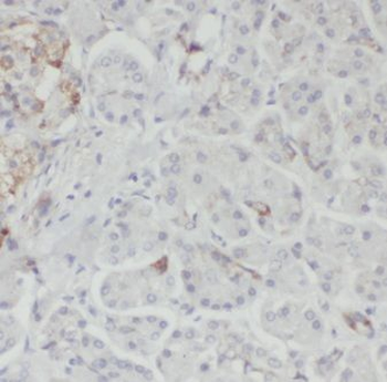 GNB1 Rabbit Polyclonal Antibody