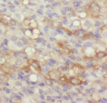 GNB2 Antibody