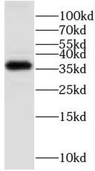 GNB3 Antibody
