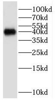 GNB5 Rabbit Polyclonal Antibody