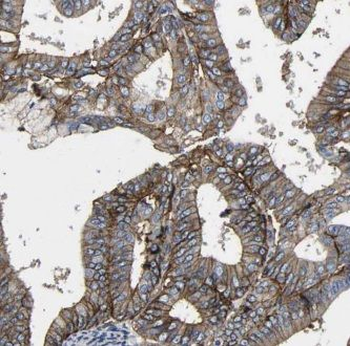 GNB5 Rabbit Polyclonal Antibody