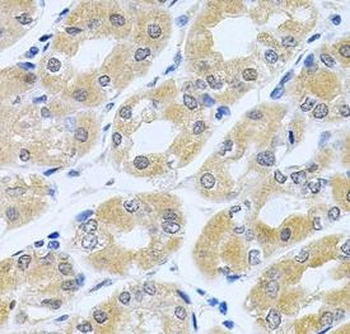 GNE Rabbit Polyclonal Antibody