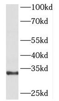 GNPDA1 Rabbit Polyclonal Antibody