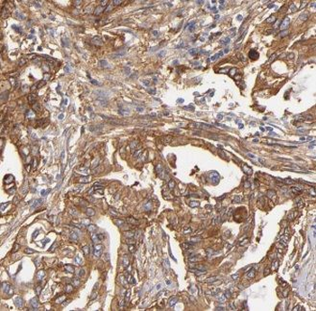 GNPDA1 Rabbit Polyclonal Antibody