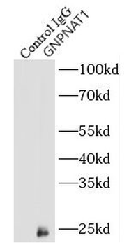 GNPNAT1 Rabbit Polyclonal Antibody