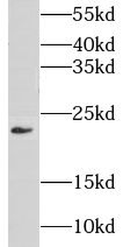 GNPNAT1 Rabbit Polyclonal Antibody