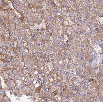 GNPNAT1 Rabbit Polyclonal Antibody