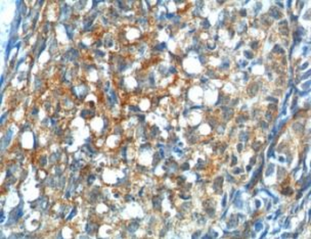 GNRHR Antibody