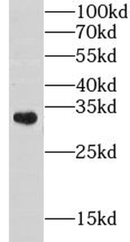 GOLPH3 Rabbit Polyclonal Antibody