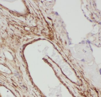 GOLPH3 Rabbit Polyclonal Antibody