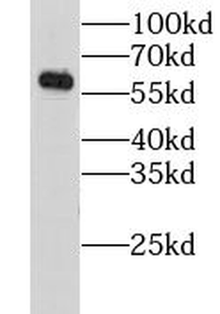 GORASP2 Rabbit Polyclonal Antibody