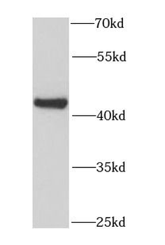 GOT2 Rabbit Polyclonal Antibody