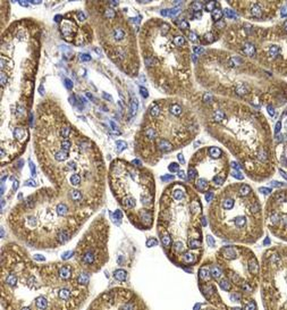 GOT2 Rabbit Polyclonal Antibody
