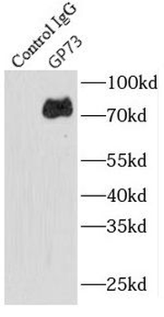 GOLM1 Rabbit Polyclonal Antibody