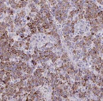 GOLM1 Rabbit Polyclonal Antibody