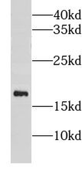 GP9 Rabbit Polyclonal Antibody