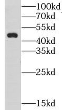 GPBP1 Rabbit Polyclonal Antibody