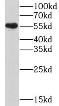 GPBP1L1 Rabbit Polyclonal Antibody