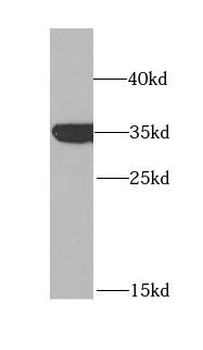 GPD1 Rabbit Polyclonal Antibody