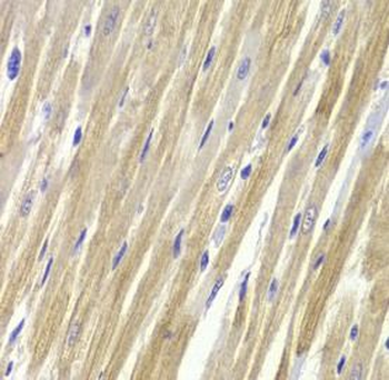 GPD1 Rabbit Polyclonal Antibody