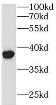 GPD1L Rabbit Polyclonal Antibody