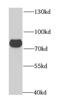 GPD2 Rabbit Polyclonal Antibody