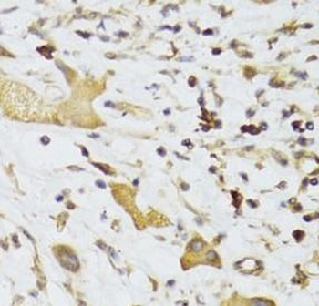 GPD2 Rabbit Polyclonal Antibody