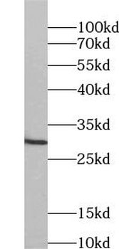 GPM6A Rabbit Polyclonal Antibody