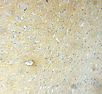 GPM6A Rabbit Polyclonal Antibody