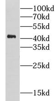 GPN1 Rabbit Polyclonal Antibody