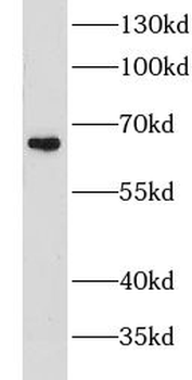 GPNMB Antibody
