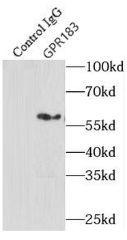GPR183 Rabbit Polyclonal Antibody