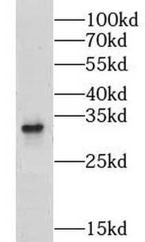 GPR35 Rabbit Polyclonal Antibody