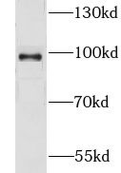 GPRASP2 Rabbit Polyclonal Antibody