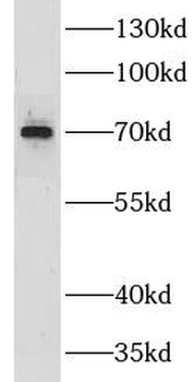 GPSM2 Rabbit Polyclonal Antibody