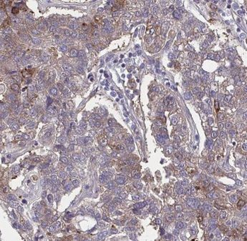 GPSM2 Rabbit Polyclonal Antibody